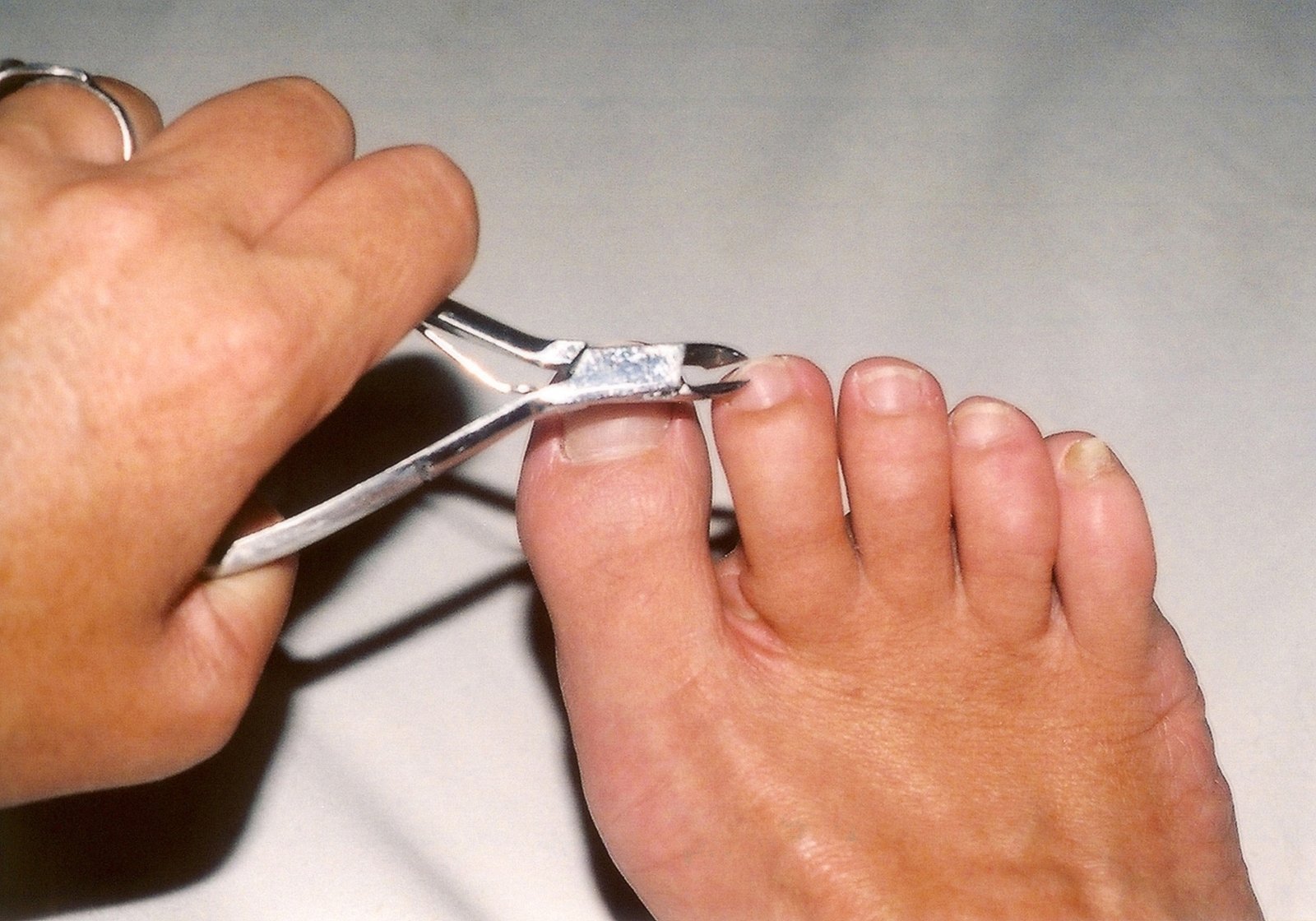 toenail-cutting-1500741